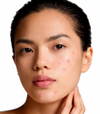 Skin Pure
